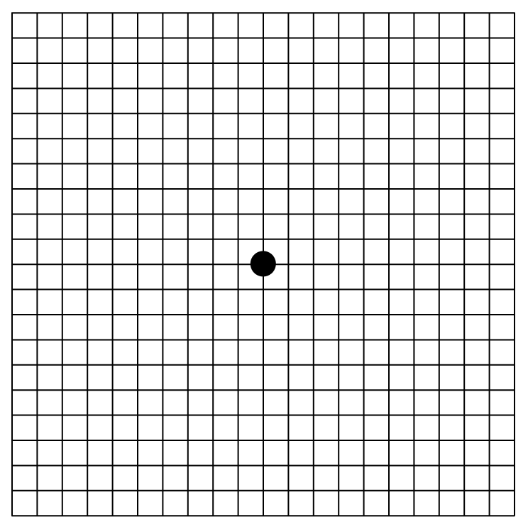 Amsler grid